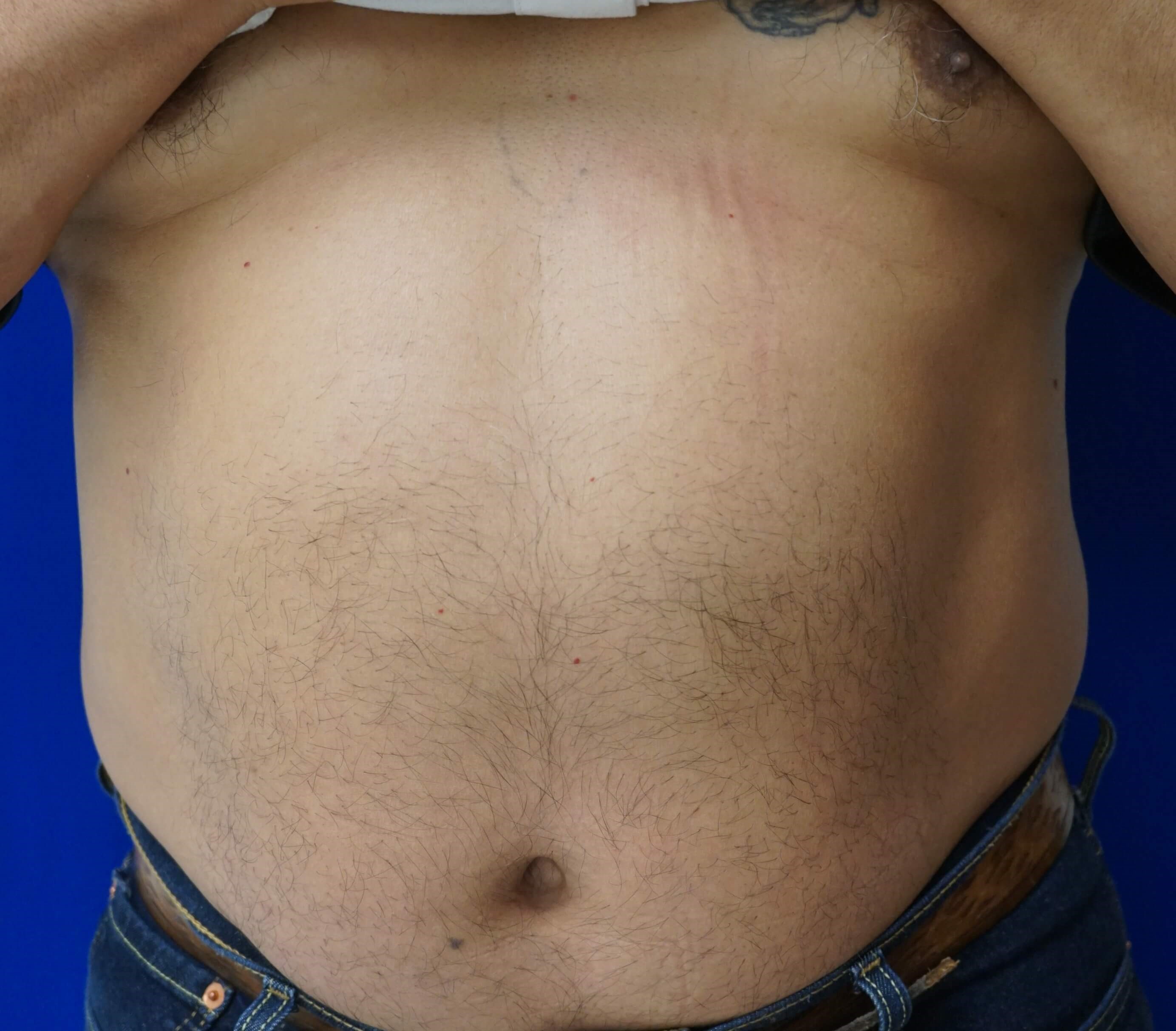 Before Image