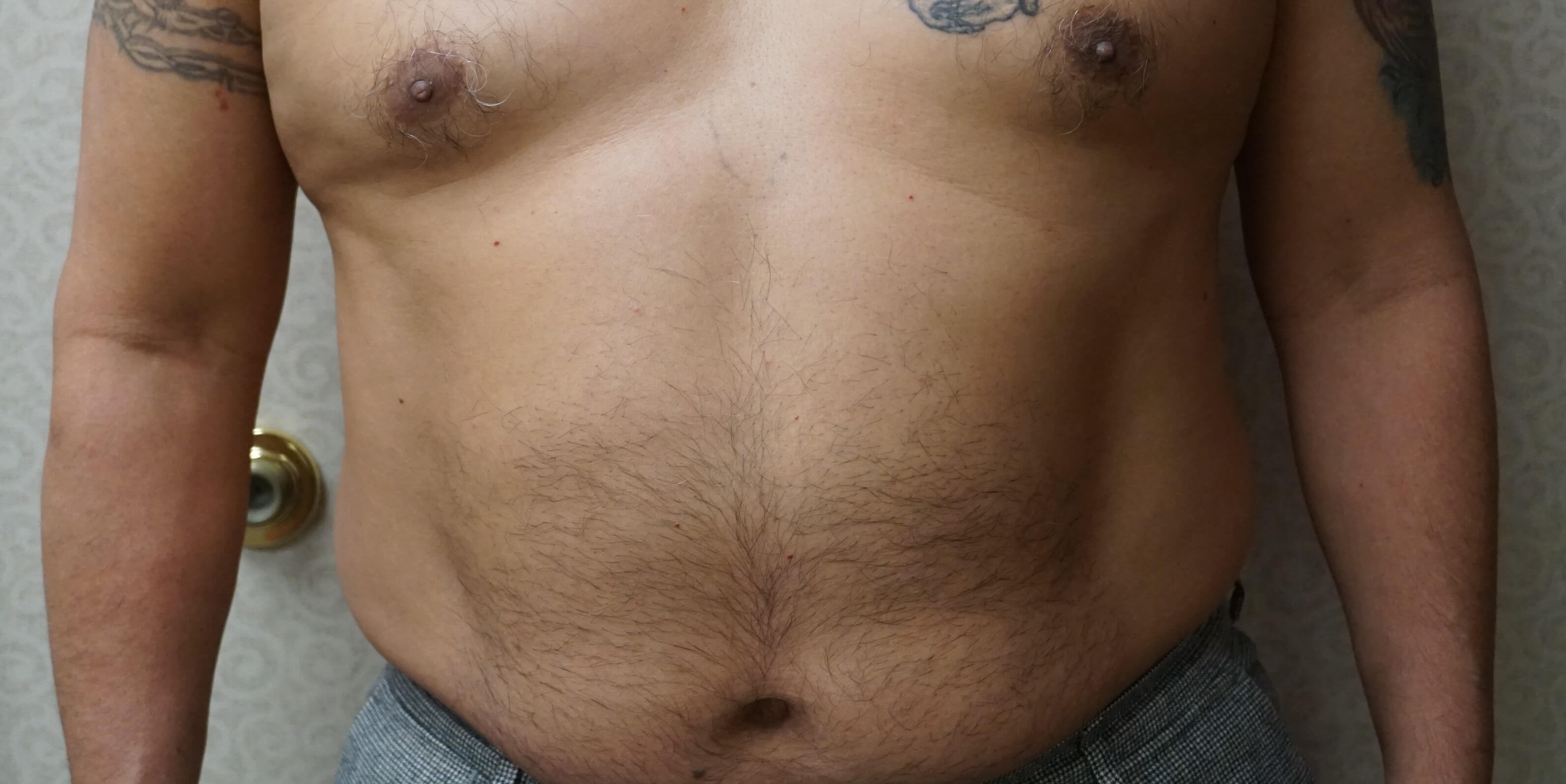 After Image